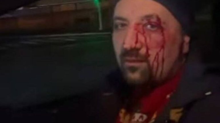 Священик ПЦУ з чотиримісячною донькою потрапив під обстріл в Запоріжжі