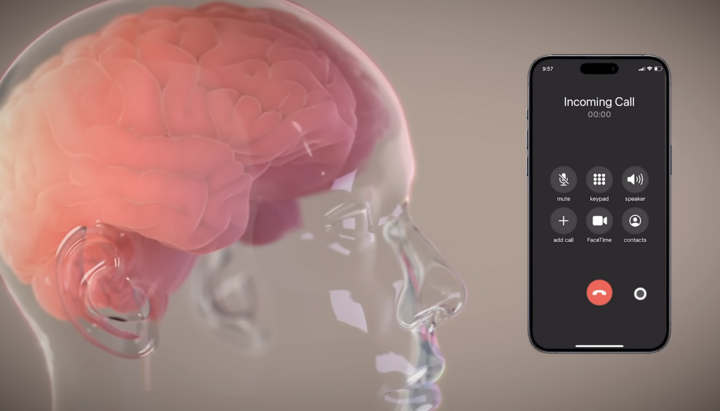 В "Neuralink" Ілона Маска розповіли про плани щодо злиття мозку із ШІ
